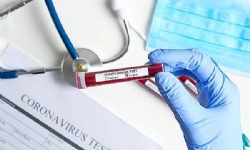 ​Karabağ’da koronavirüs iddiası yalanlandı