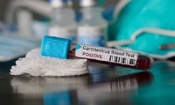 ​Ermenistan’da koronavirüs vakaları 290’a ulaştı, onlardan 18’i iyileşti, ölüm yok