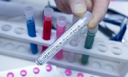 İngiltere eski doktor ve hemşireleri görev çağırdı