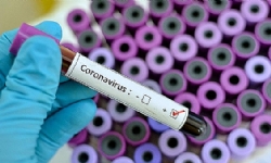 ​31 Mart: Ermenistan`da koronavirüs kaynaklı son durum
