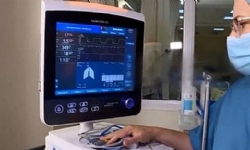 ​Ermeni “YEA Engineering” şirketi, NASA JPLden akciğer cihazı üretme lisansı aldı