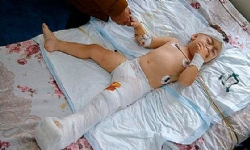 Karabağ’da ağır bombardımanın ardından yaralanan 2 yaşındaki çocuk ameliyat edildi